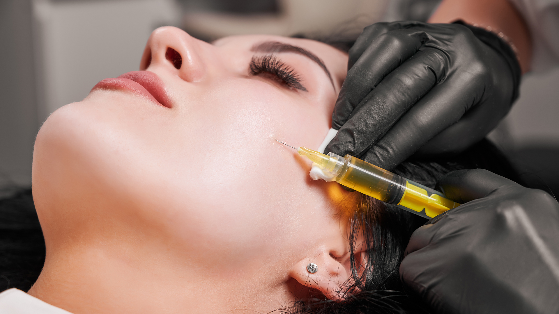 Plazmolifting prosedurunda kampaniya: 3 alana 1 hədiyyə!